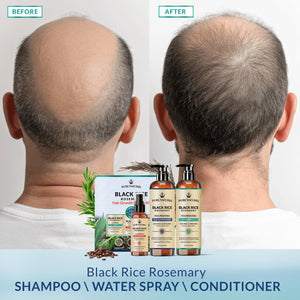 Rosemary Black Rice Water Hair Growth System Kit - Shampoo, Conditioner and Leave-in Serum