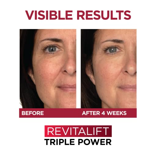 L'Oreal Paris Revitalift Triple Power Anti-Aging Face Moisturizer, Pro Retinol, Hyaluronic Acid & Vitamin C to Reduce Wrinkles, Firm & Brighten Skin, 1.7 Oz
