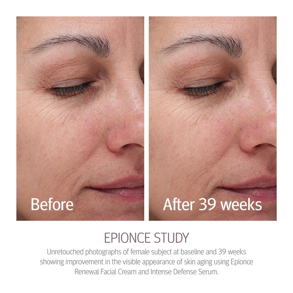 Epionce Renewal Facial Cream - Hydrating Face Moisturizer, Anti Aging & Dry Skin Barrier Repair Face Cream with Glycerin, Dry Skin Face Moisturizer